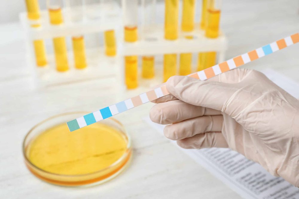 Microbiological Test